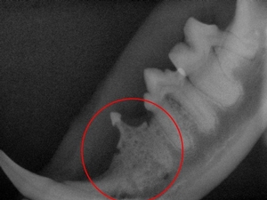 Dental Xray: root resorption